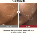 Dr.Melaxin Peel Shot Glow White Rice Toner 200ml | Lakinza K - beauty Canada