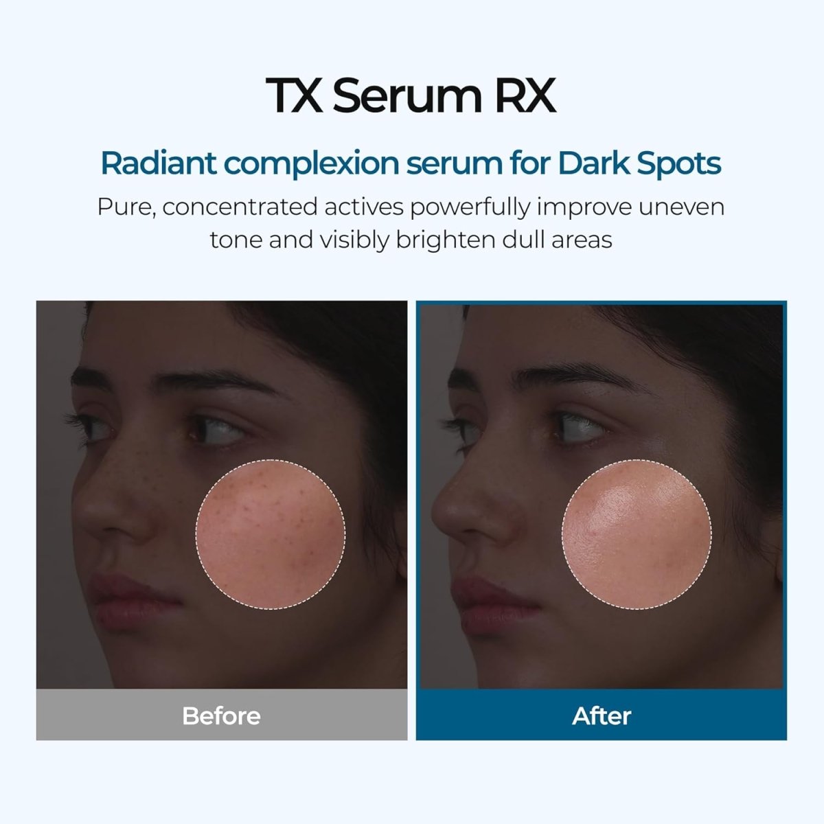 Dr.Melaxin TX Ampoule 30ml | Lakinza K - beauty Canada
