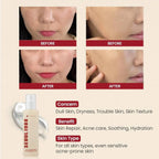 KSECRET SEOUL 1988 Essence: Snail Mucin 97% + Rice 100ml | Lakinza K - beauty Canada