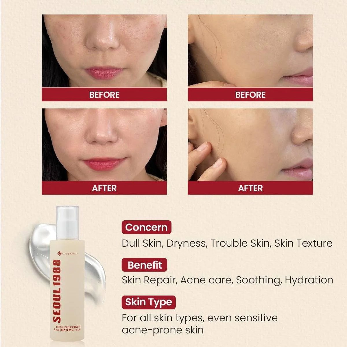 KSECRET SEOUL 1988 Essence: Snail Mucin 97% + Rice 100ml | Lakinza K - beauty Canada