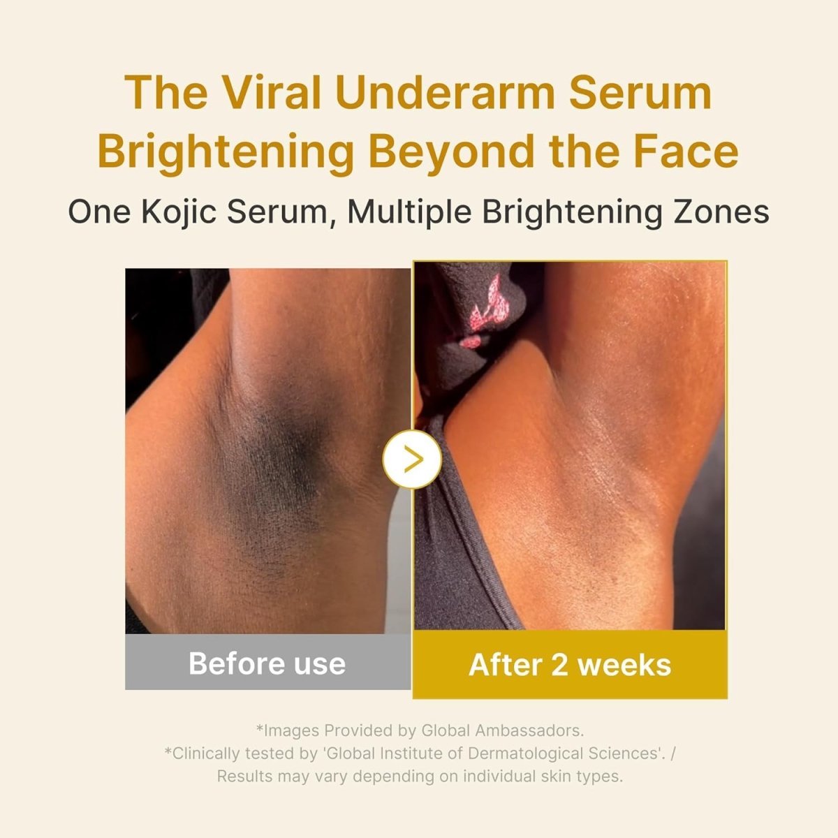 Medicube Hyperpigmentation Glass Skin Routine | Lakinza K - beauty Canada