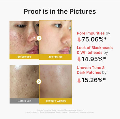 Medicube Kojic Acid Turmeric Peel Shot 80ml | Lakinza K - beauty Canada