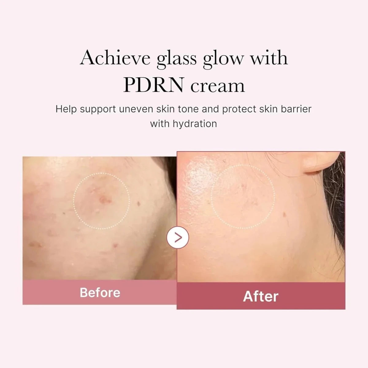 Medicube PDRN Pink Hyaluronic Moisturizing Cream 50ml Lakinza K-beauty