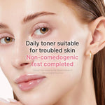 Medicube PDRN Pink Niacinamide Milky Toner 150ml Lakinza K-beauty