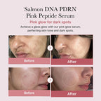 medicube PDRN Pink One Day Serum Set 1.5mlx10 | Lakinza K - beauty Canada