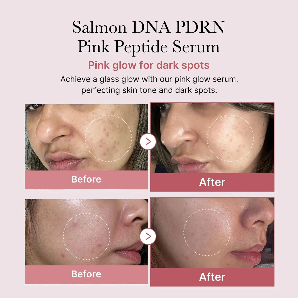 medicube PDRN Pink One Day Serum Set 1.5mlx10 | Lakinza K - beauty Canada