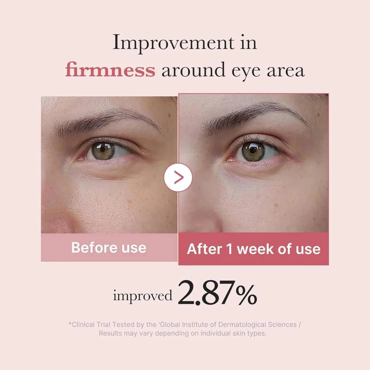 Medicube PDRN Pink Peptide Eye Serum 30ml | Lakinza K - beauty Canada
