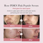 Medicube PDRN Pink Peptide Serum 30ml | Lakinza K - beauty Canada
