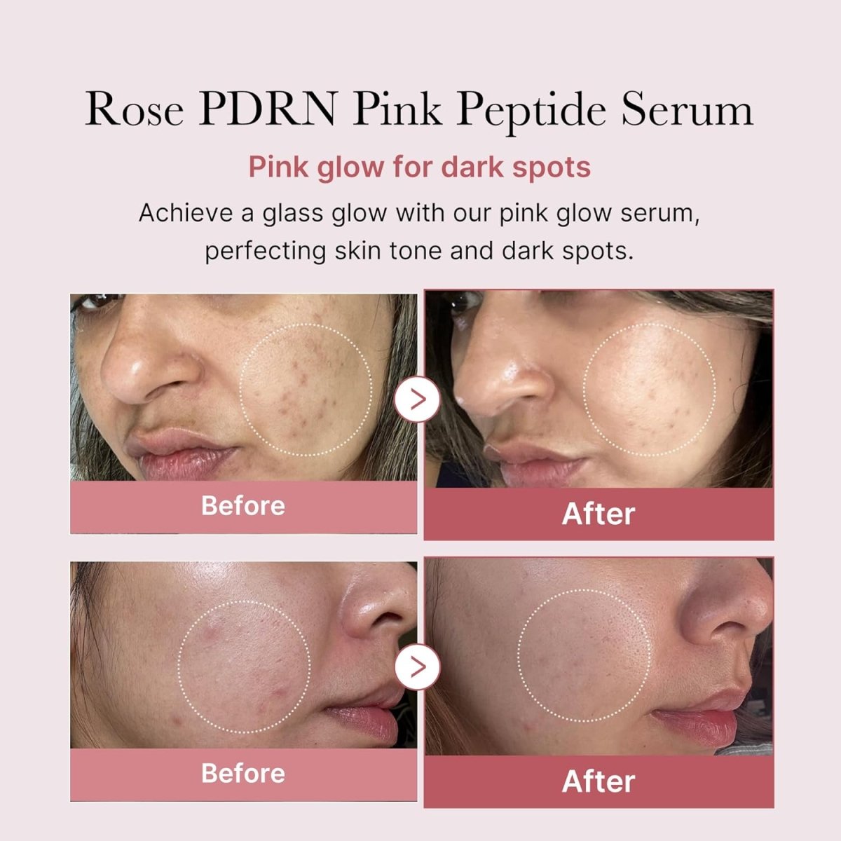 Medicube Pink PDRN Anti - aging Routine | Lakinza K - beauty Canada