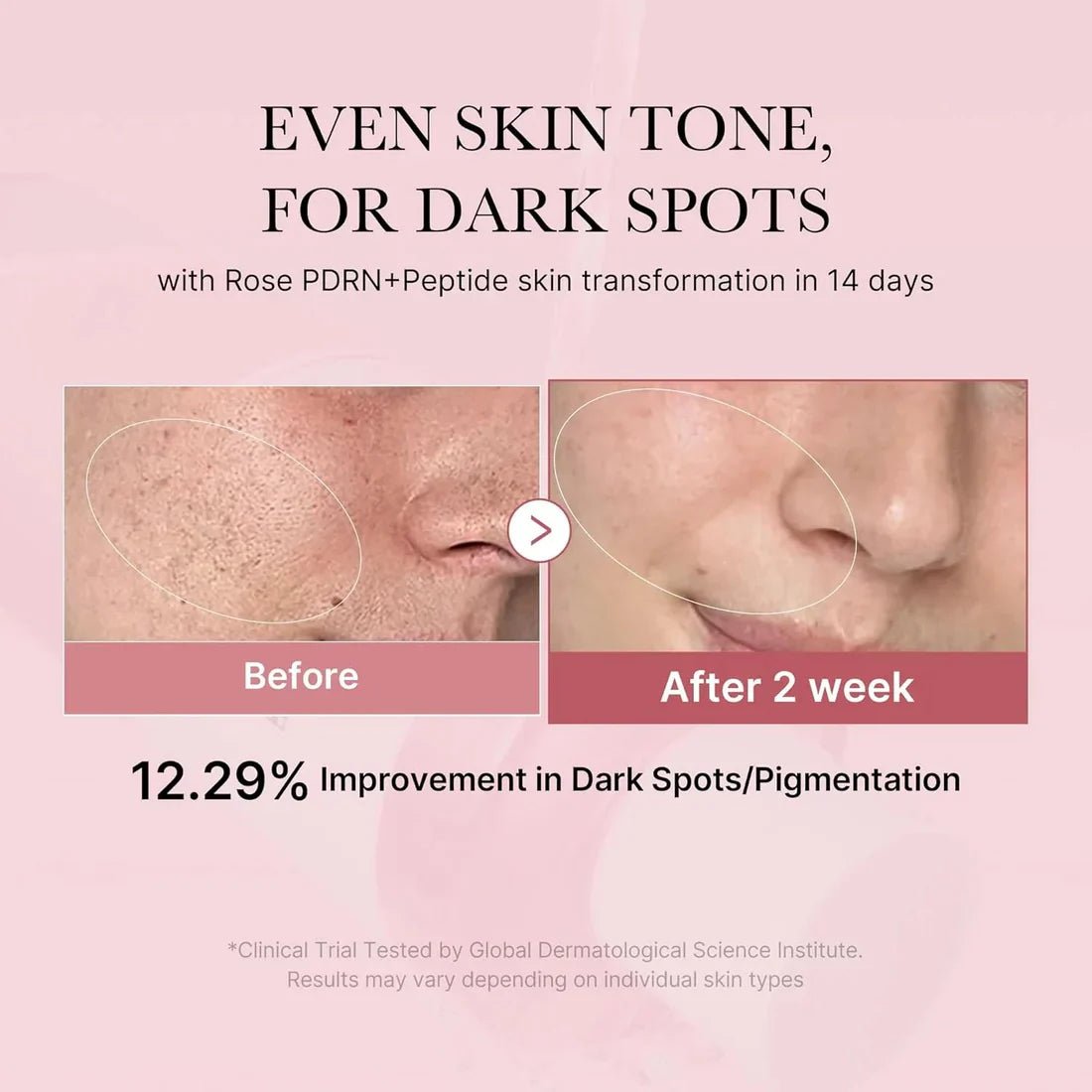 Medicube Pink PDRN Anti - aging Routine | Lakinza K - beauty Canada