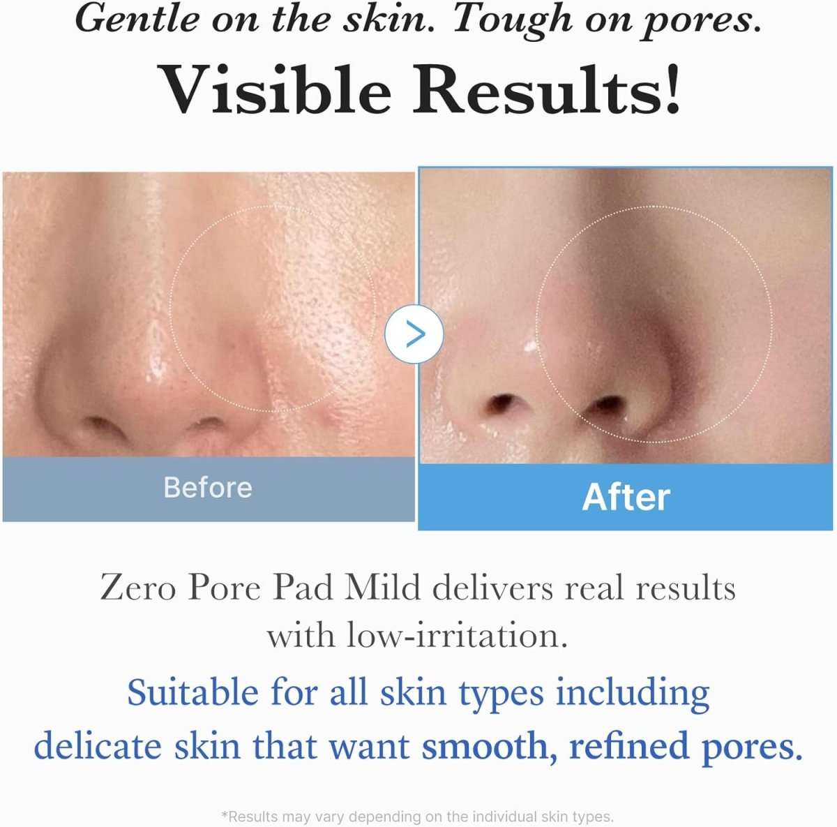 Medicube Zero Pore Pad 155g / 70 pads Lakinza K-beauty