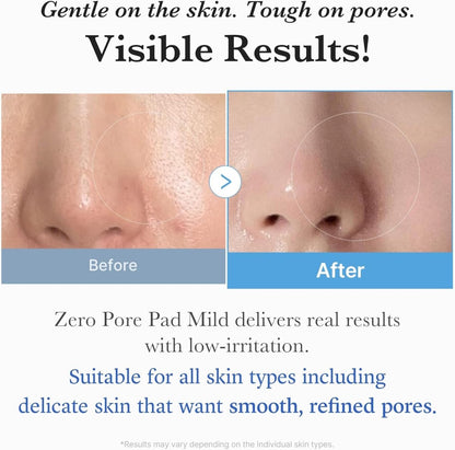 Medicube Zero Pore Pad 155g / 70 pads | Lakinza K - beauty Canada