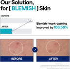 Mediheal Madecassoside Blemish Serum 40ml | Lakinza K - beauty Canada