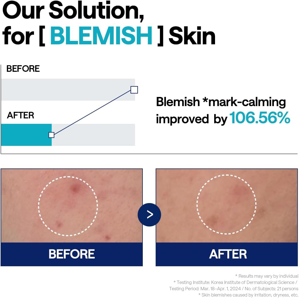 Mediheal Madecassoside Blemish Serum 40ml | Lakinza K - beauty Canada