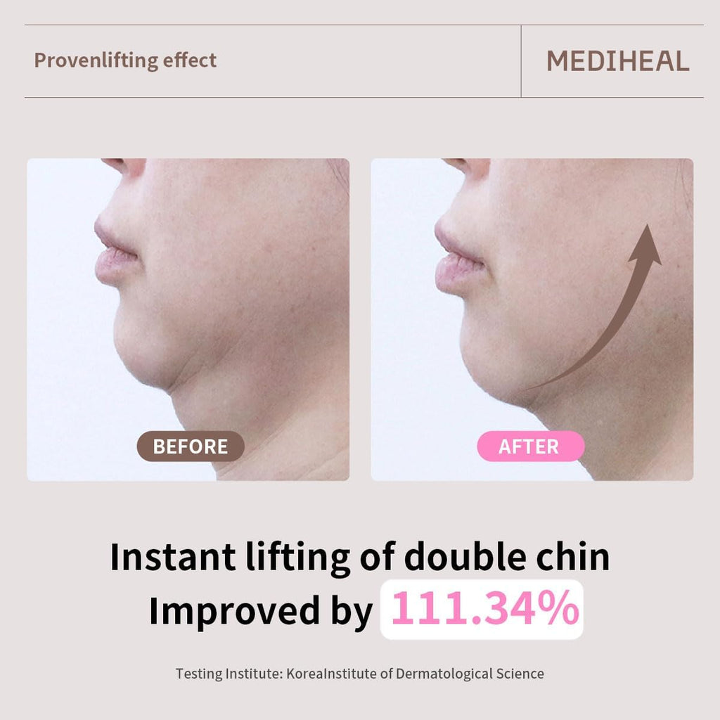 Mediheal Retinol Collagen Ampoule Lifting Mask 30ml | Lakinza K - beauty Canada
