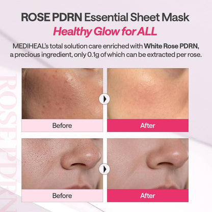 Mediheal Rose PDRN Essential Mask_Healthy Glow 24ml | Lakinza K - beauty Canada