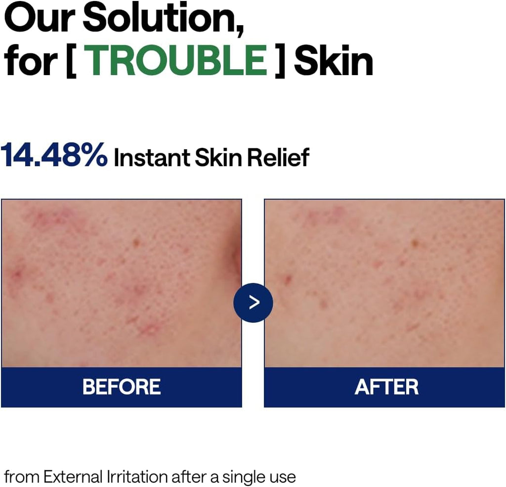 Mediheal Teatree Calming Hydra Serum 40ml | Lakinza K - beauty Canada
