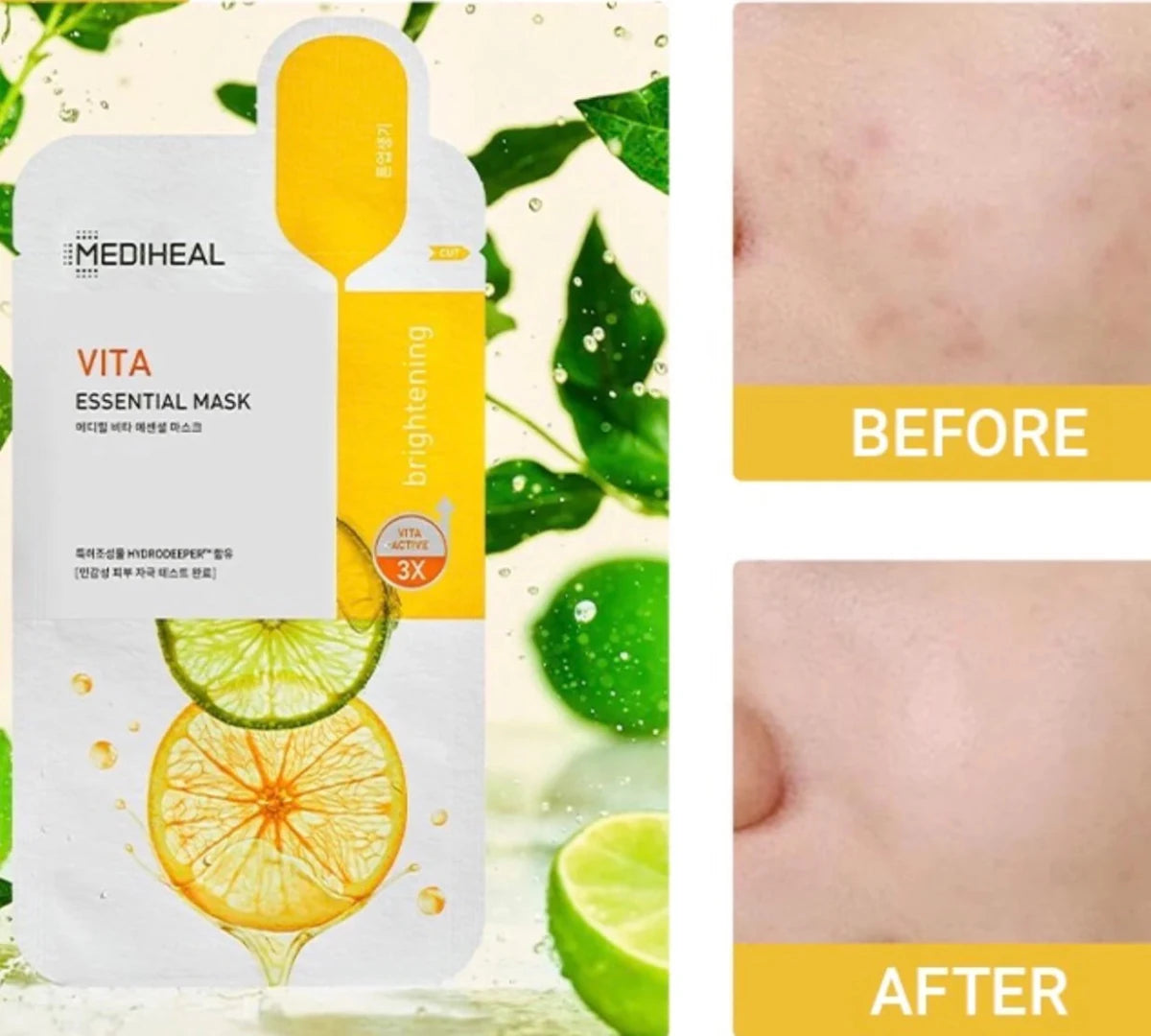 Mediheal Vita Essential Mask 24g | Lakinza K - beauty Canada