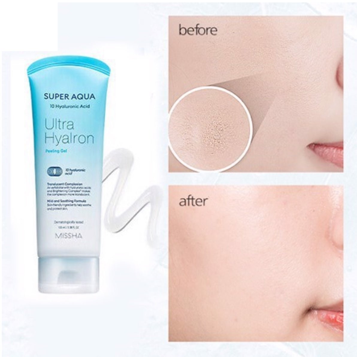 MISSHA Super Aqua Ultra Hyalron Peeling Gel 100ml Lakinza K-beauty