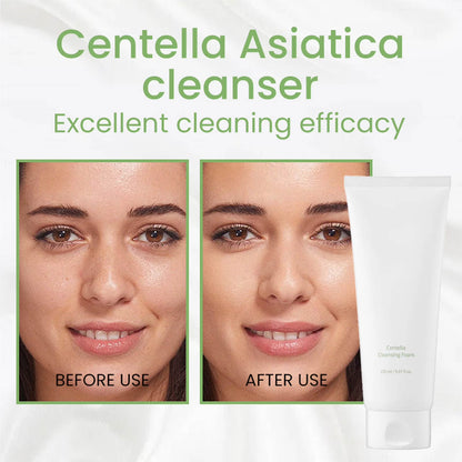 mixsoon Centella Mousse Nettoyante 150 ml