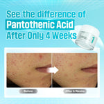 Numbuzin No.1 Pantothenic B5 Active Soothing Cream 80ml Lakinza K-beauty