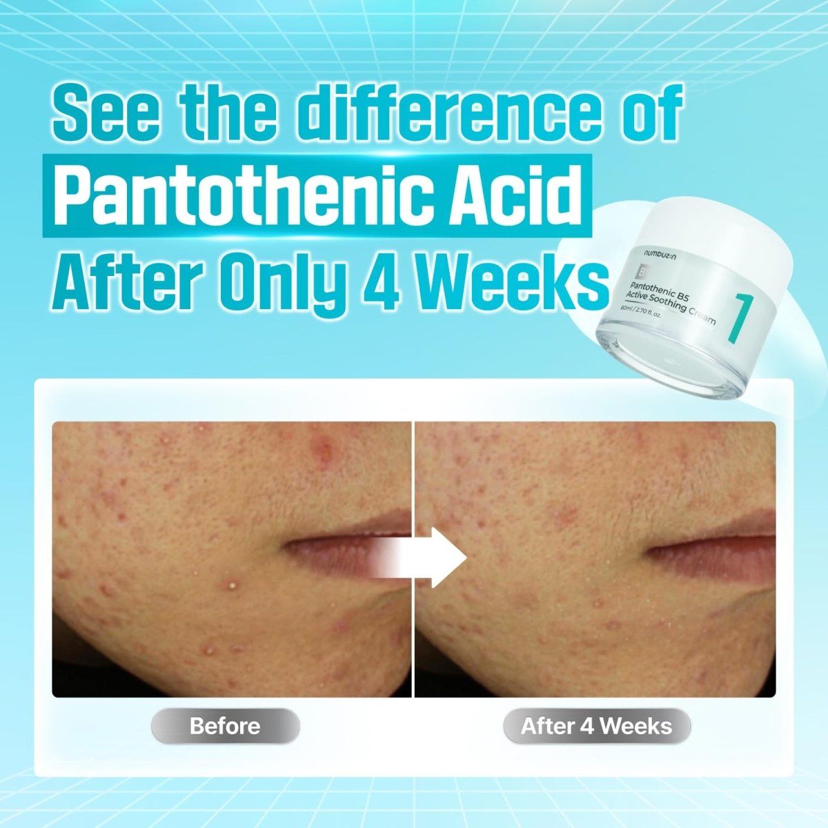 Numbuzin No.1 Pantothenic B5 Active Soothing Cream 80ml Lakinza K-beauty