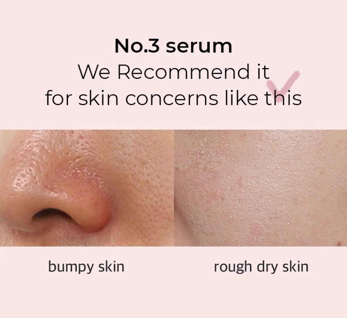 Numbuzin No.3 Bodlebodle Repair Serum 50ml Lakinza K-beauty
