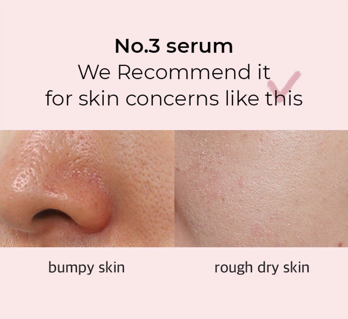 Numbuzin No.3 Bodlebodle Repair Serum 50ml | Lakinza K - beauty Canada