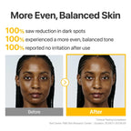 numbuzin No.5 Glutathione100 x TXA10 Advanced Dark Spot Ampoule Concentrate 10g | Lakinza K - beauty Canada