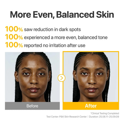 numbuzin No.5 Glutathione100 x TXA10 Advanced Dark Spot Ampoule Concentrate 10g | Lakinza K - beauty Canada