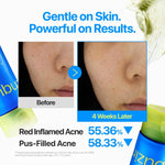 Numbuzin Zero Blemish Clarifying 2% Sulfur Cleansing Foam 150ml Lakinza K-beauty