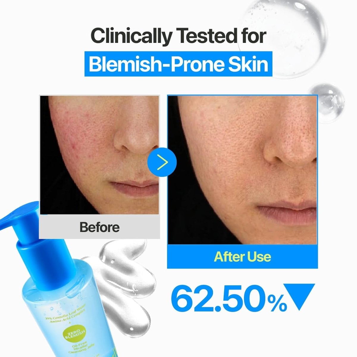 Numbuzin Zero Blemish Oil-Free Micellar Cleansing Jelly 200ml Lakinza K-beauty