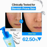 Numbuzin Zero Blemish Oil-Free Micellar Cleansing Jelly 200ml Lakinza K-beauty