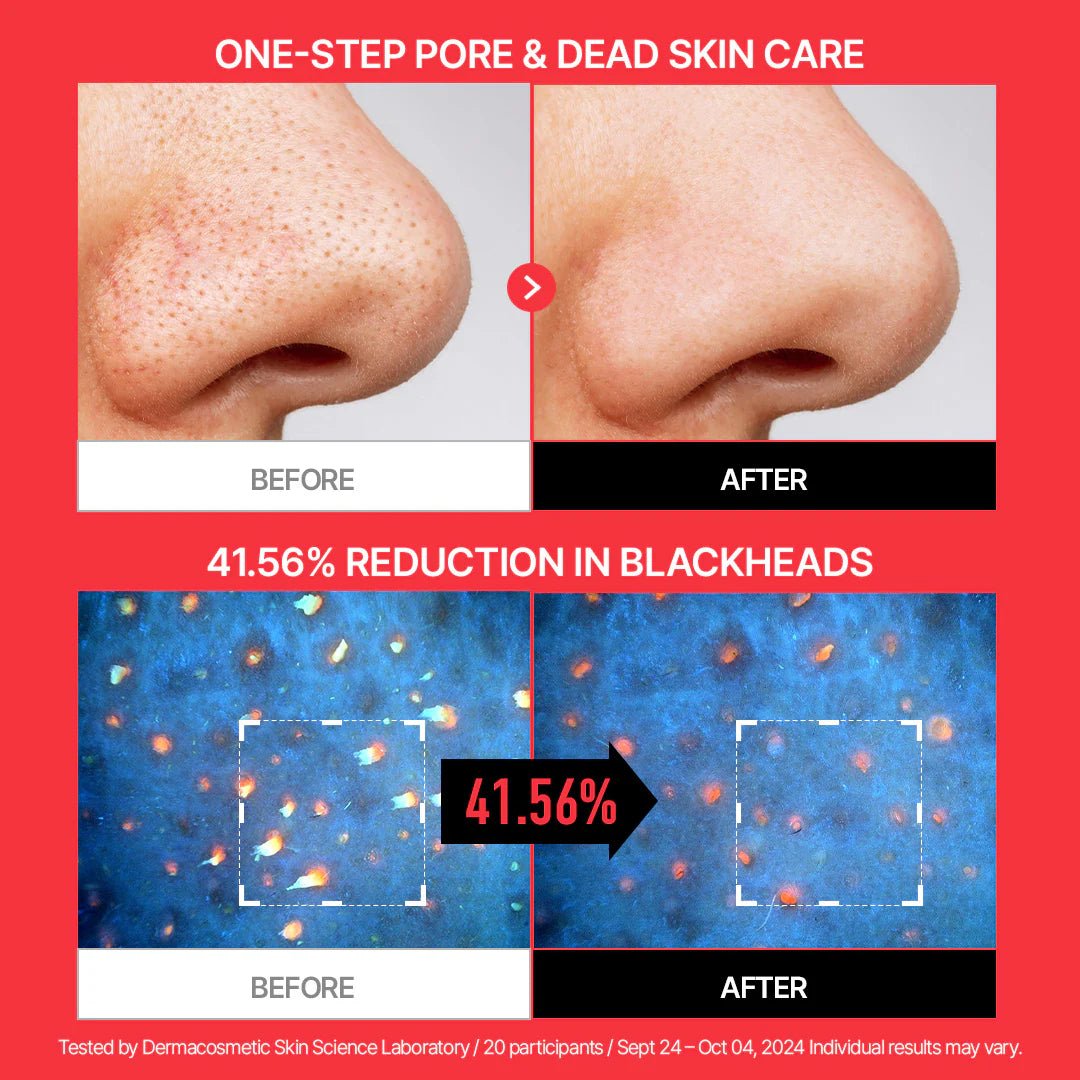 Parnell AHA Omija Ceramic Bubble Peeling Cleanser 180ml | Lakinza K - beauty Canada