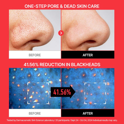 Parnell AHA Omija Ceramic Bubble Peeling Cleanser 180ml | Lakinza K - beauty Canada