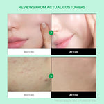 Parnell Cicamanu Gel Cream 75ml Lakinza K-beauty