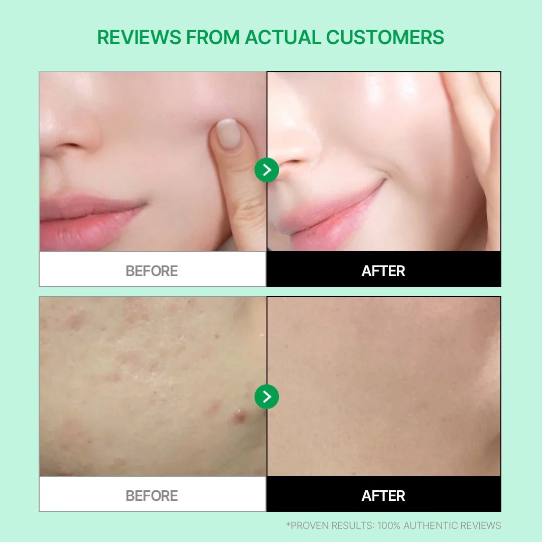 Parnell Cicamanu Gel Cream 75ml | Lakinza K - beauty Canada