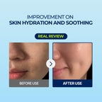 PO:DL Barley Hyal - Some HydroMask 36g | Lakinza K - beauty Canada