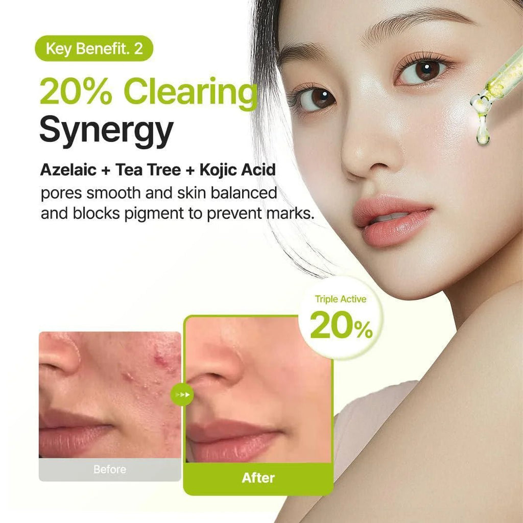 Purito Azelaic Acid 10 Kojic Tea Tree Serum 30ml | Lakinza K - beauty Canada