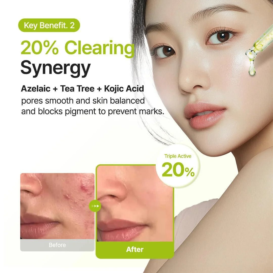 Purito Azelaic Acid 10 Kojic Tea Tree Serum 30ml | Lakinza K - beauty Canada