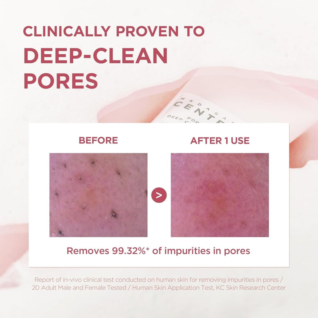 SKIN1004 Madagascar Centella Poremizing Deep Cleansing Foam 125ml | Lakinza K - beauty Canada