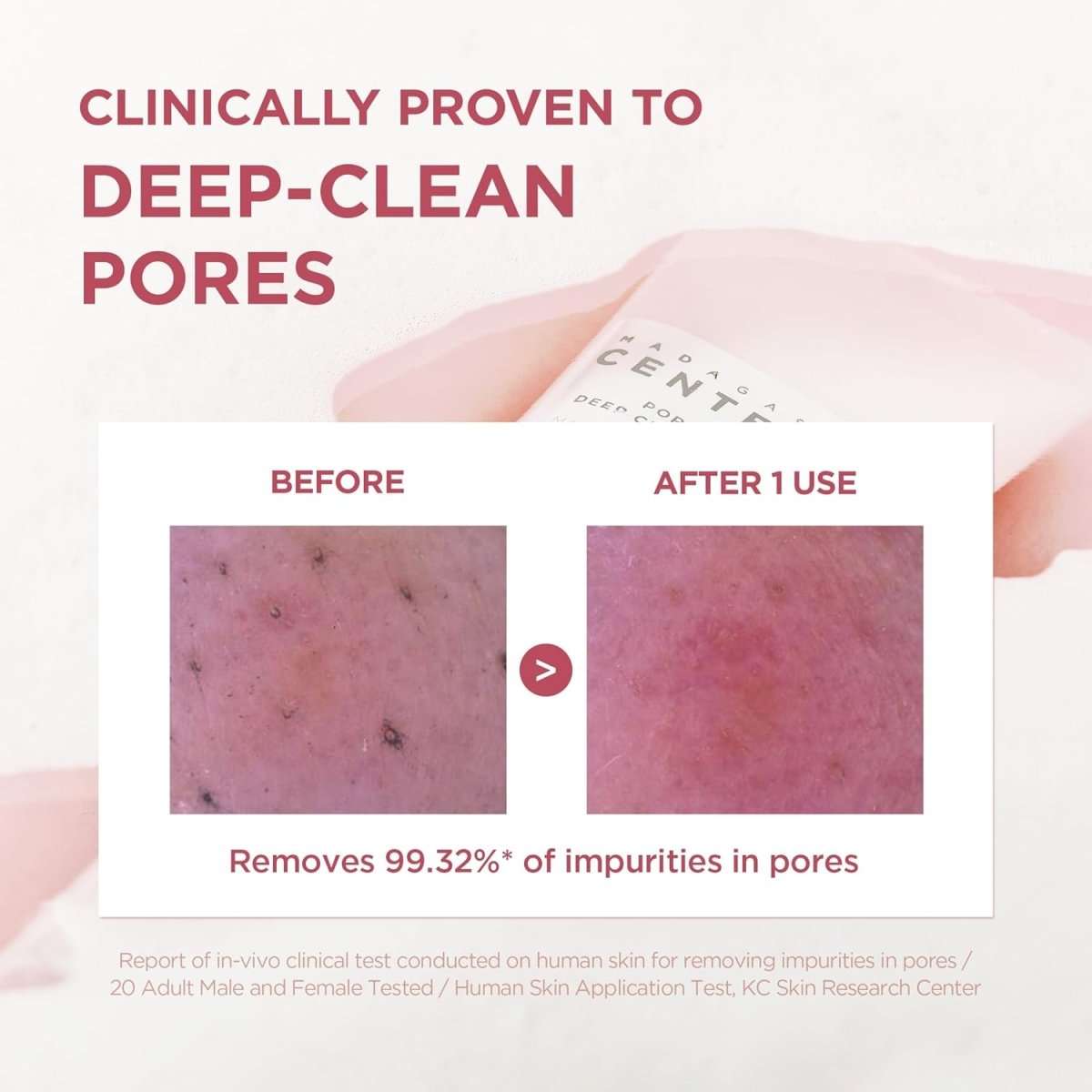 SKIN1004 Madagascar Centella Poremizing Deep Cleansing Foam 125ml Lakinza K-beauty