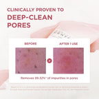SKIN1004 Madagascar Centella Poremizing Deep Cleansing Foam 125ml | Lakinza K - beauty Canada