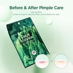 SKIN1004 Spot Cover Patch 22pcs | Lakinza K - beauty Canada