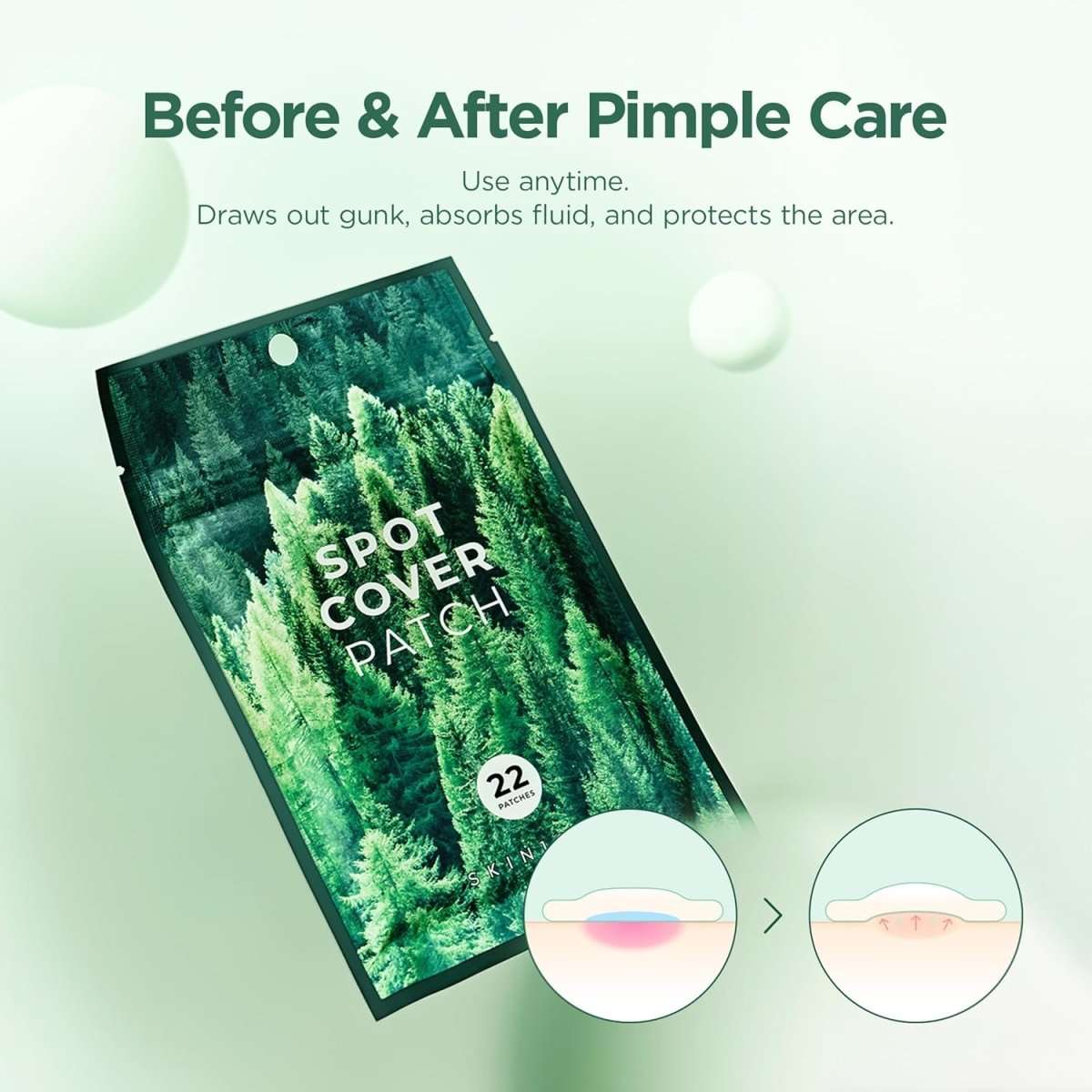 SKIN1004 Spot Cover Patch 22pcs Lakinza K-beauty