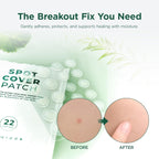 SKIN1004 Spot Cover Patch 22pcs | Lakinza K - beauty Canada