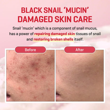 SOME BY MI Snail Truecica Miracle Cream 60g | Lakinza K - beauty Canada