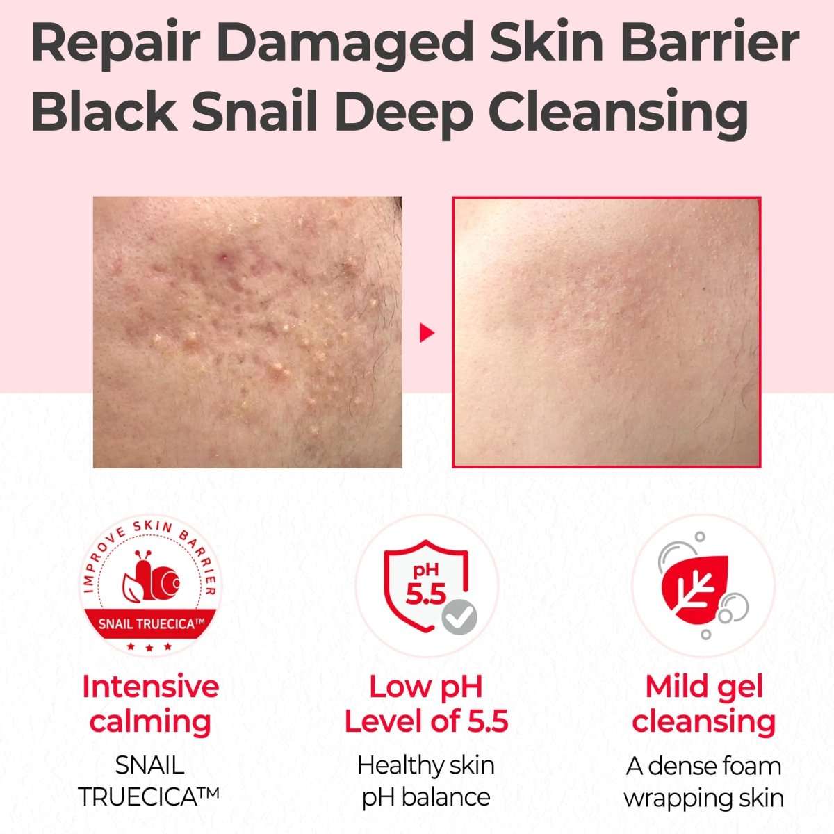 SOME BY MI Snail Truecica Miracle Low Ph Gel Cleanser 100ml Lakinza K-beauty