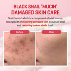 SOME BY MI Snail Truecica Miracle Serum 50ml | Lakinza K - beauty Canada