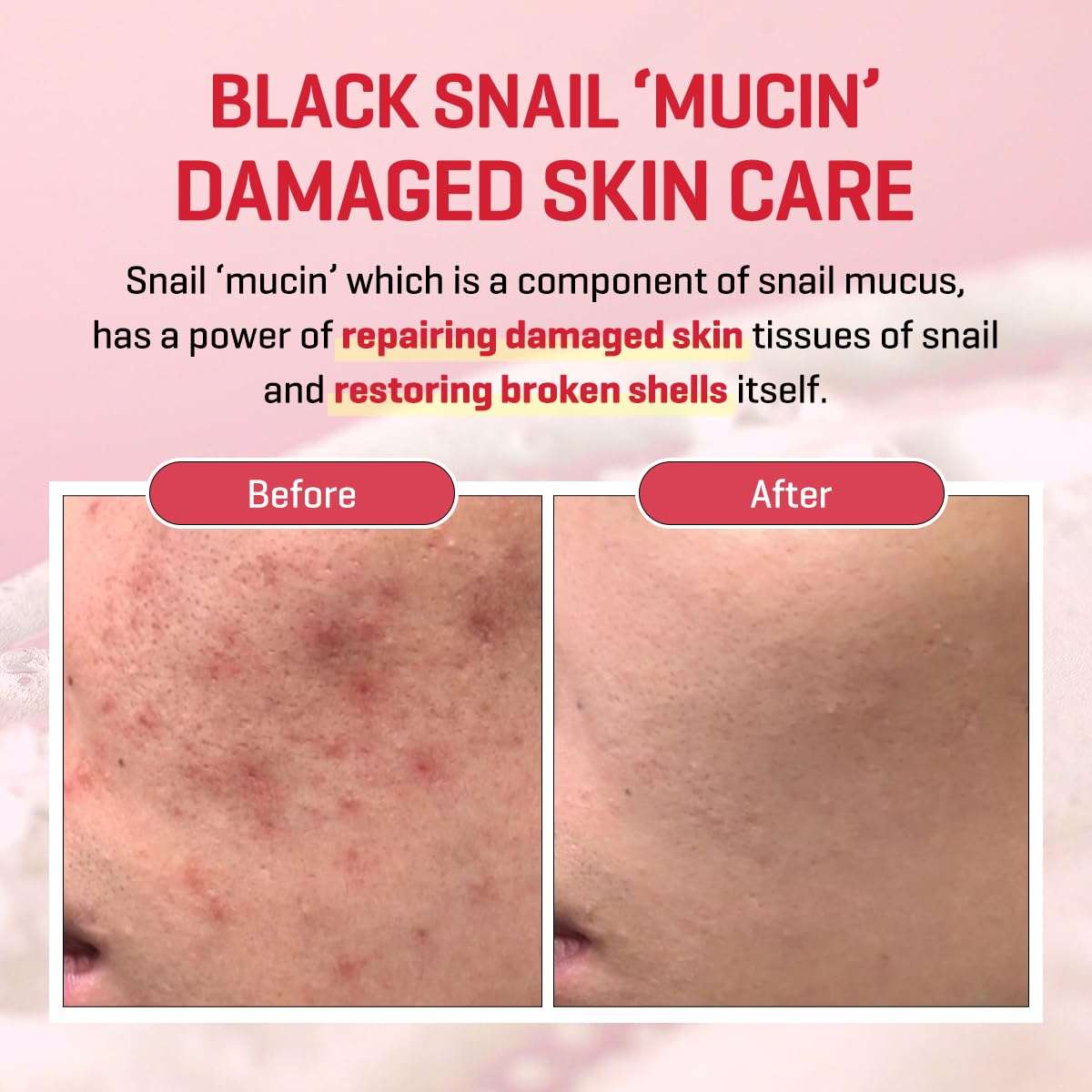 SOME BY MI Snail Truecica Miracle Serum 50ml Lakinza K-beauty